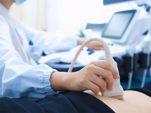 医生给孕妇做b超视频,孕妇宝宝健康监测之旅